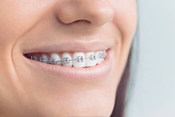 Oral Surgery in Pinecrest, FL